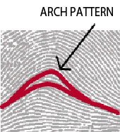 Arch Pattern